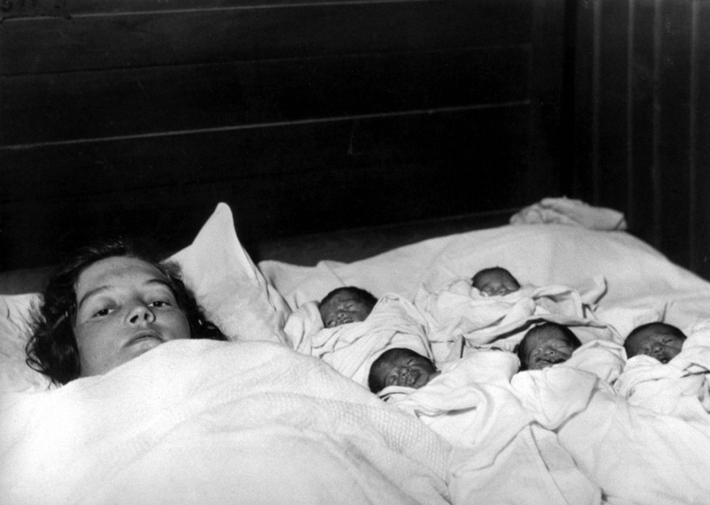 Эти 5 девочек родились однояйцевыми близнецами. Но их жизнь превратилась в ад...