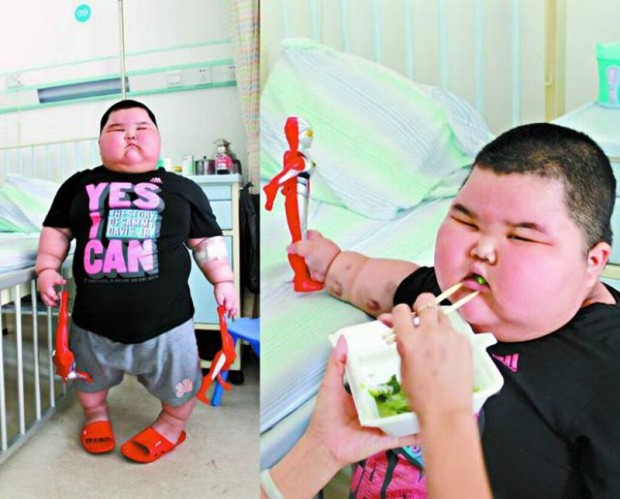 Заставляет задуматься: ТОП-8 детей, которые страдают ожирением