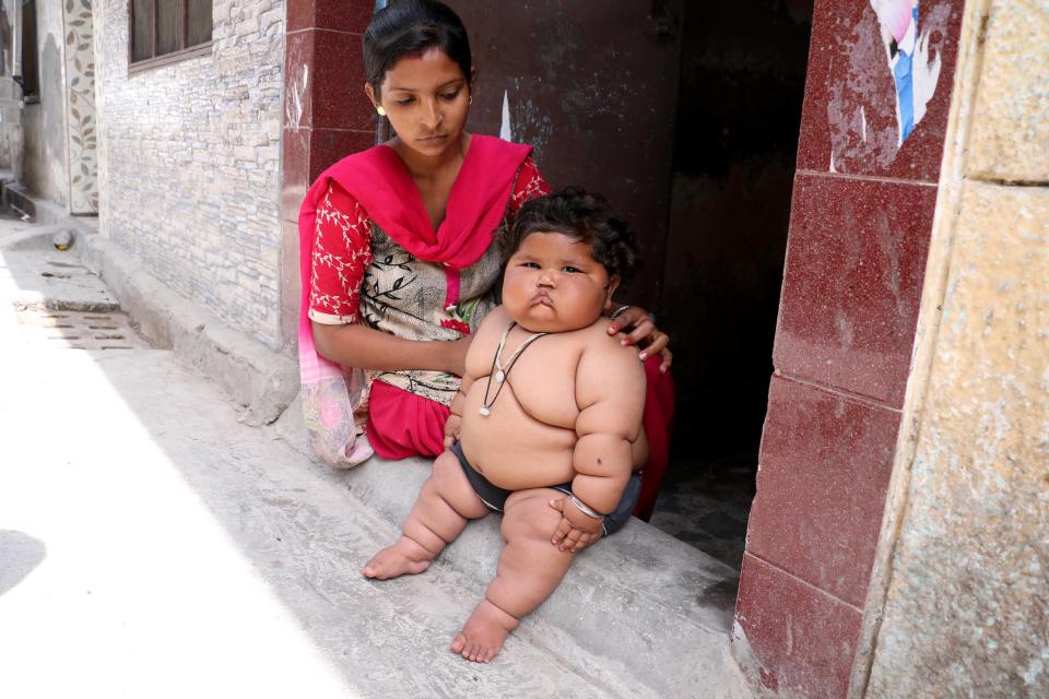 Эта девочка весит уже 17 кг, хотя ей всего 8 месяцев