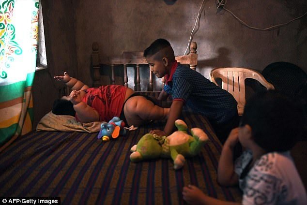 Самый толстый ребенок в мире из Мексики: в свои 10 лет он весит 28 кг
