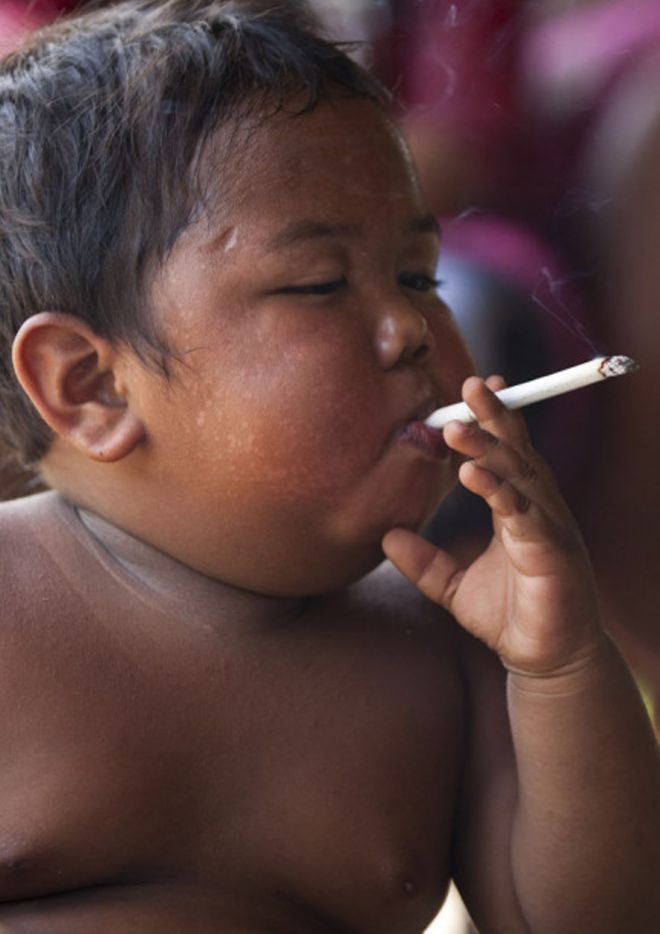 40 сигарет в день: что стало с мальчиком, который курил с 18 месяцев