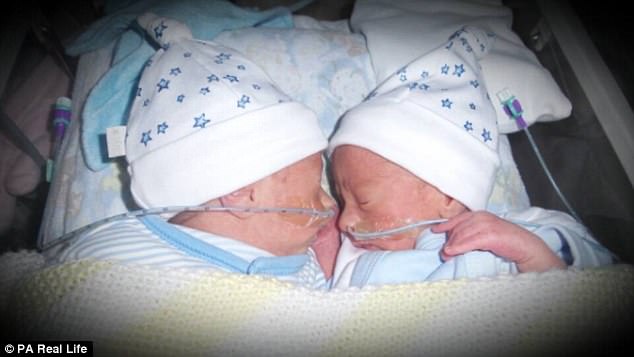 Шанс умереть 50%: как крепкие объятия близнецов спасли им жизнь