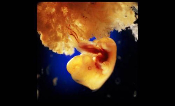 Как зарождается жизнь: 23 реальных кадра из утробы матери