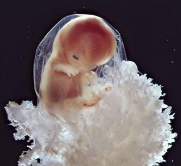 Как зарождается жизнь: 23 реальных кадра из утробы матери