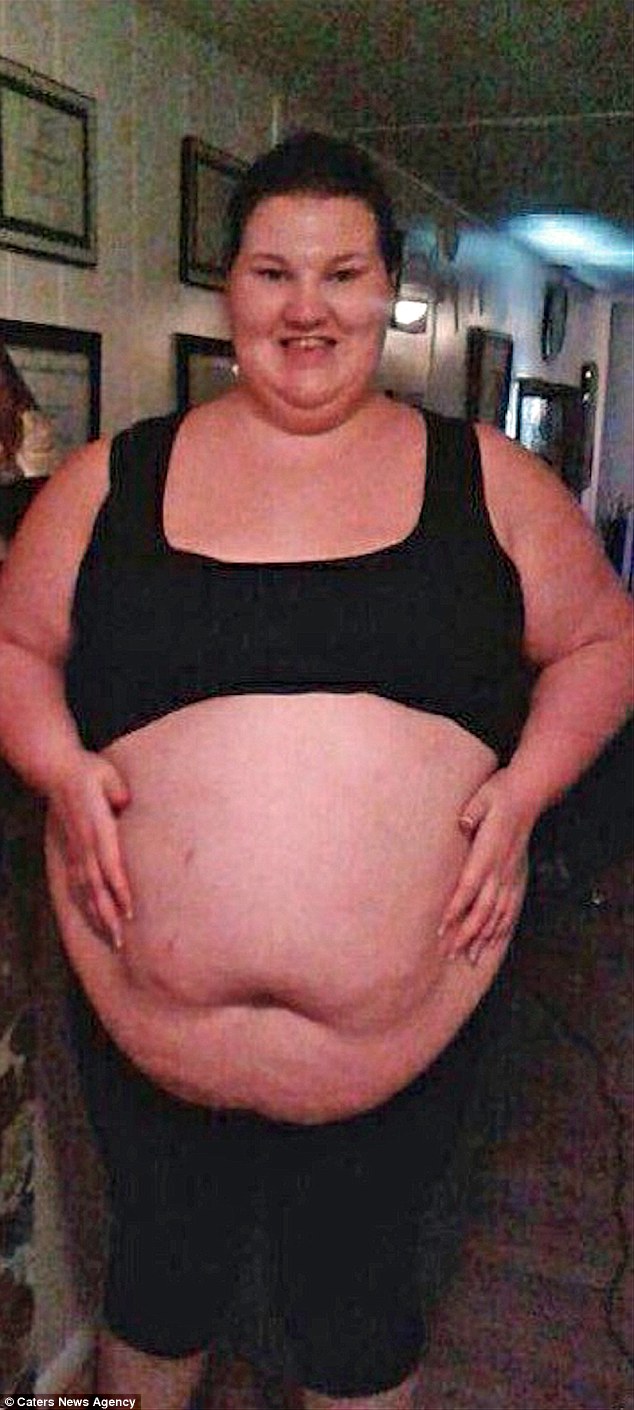 Похудеть, чтобы выжить: молодая мама сбросила 100 кг - после инсульта