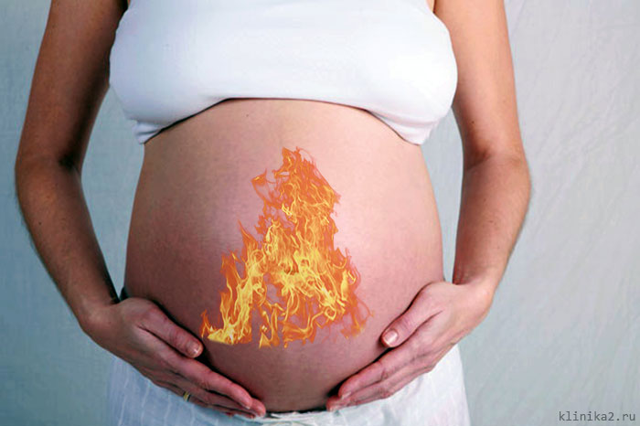 Побочные эффекты: 7 неприятностей, которые ждут при беременности