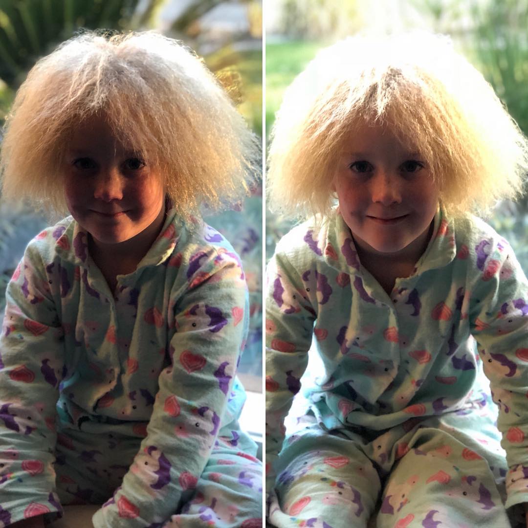 Синдром непослушных волос: девочка из Австралии покорила Instagram