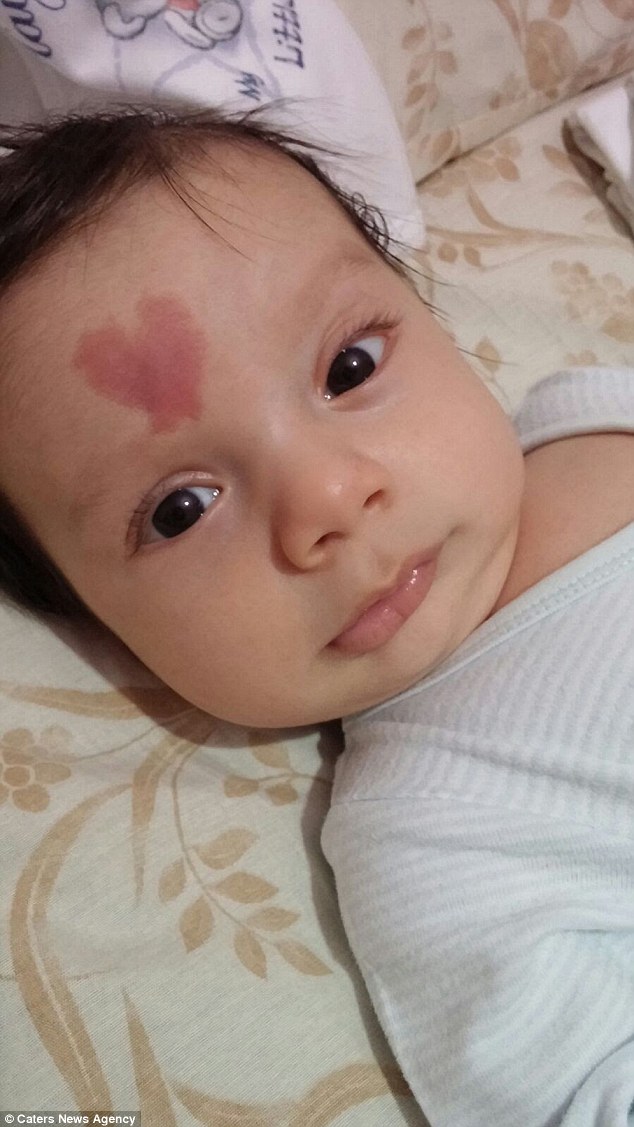 Мальчик с сердечком на лбу: у пары из Турции родился уникальный ребенок