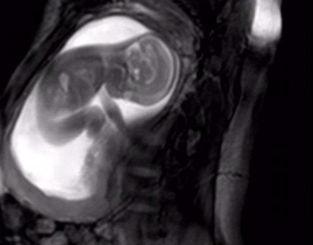 Чудо-МРТ для беременных: в Лондоне делают супер-четкие снимки в утробе