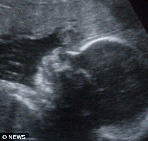 Чудо-МРТ для беременных: в Лондоне делают супер-четкие снимки в утробе