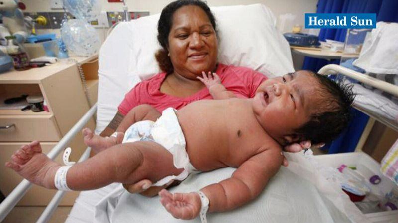 Богатырь!: мама из Австралии родила мальчика весом в 6,3 кг