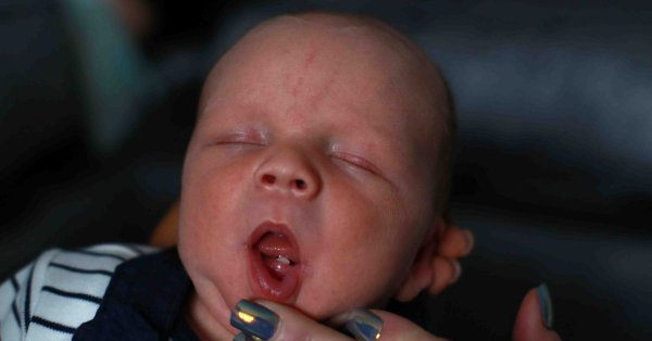 Один на 3000: в Англии родился малыш с зубом