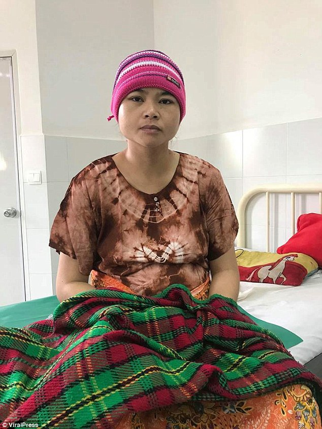 Женщина из Камбоджи родила сиамских близнецов с одним телом и двумя головами