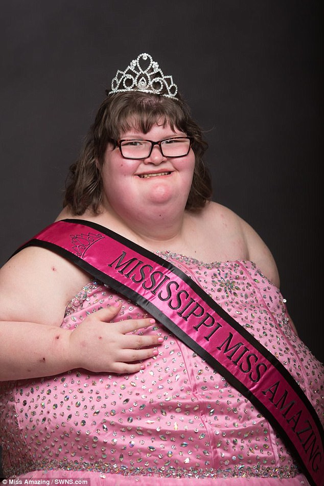 172-килограммовая девочка с синдромом Прадера-Вилли стала королевой красоты