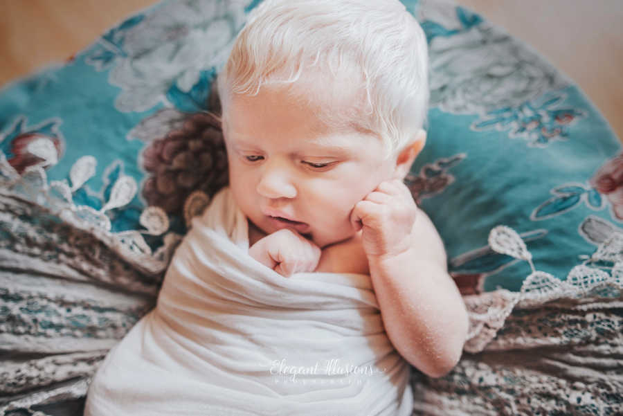 Американка рассказала, каково быть мамой альбиноса и что она пережила после родов