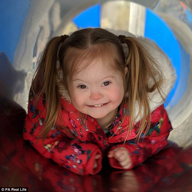 Диагноз — не преграда: 3-летняя малышка с синдромом Дауна стала моделью