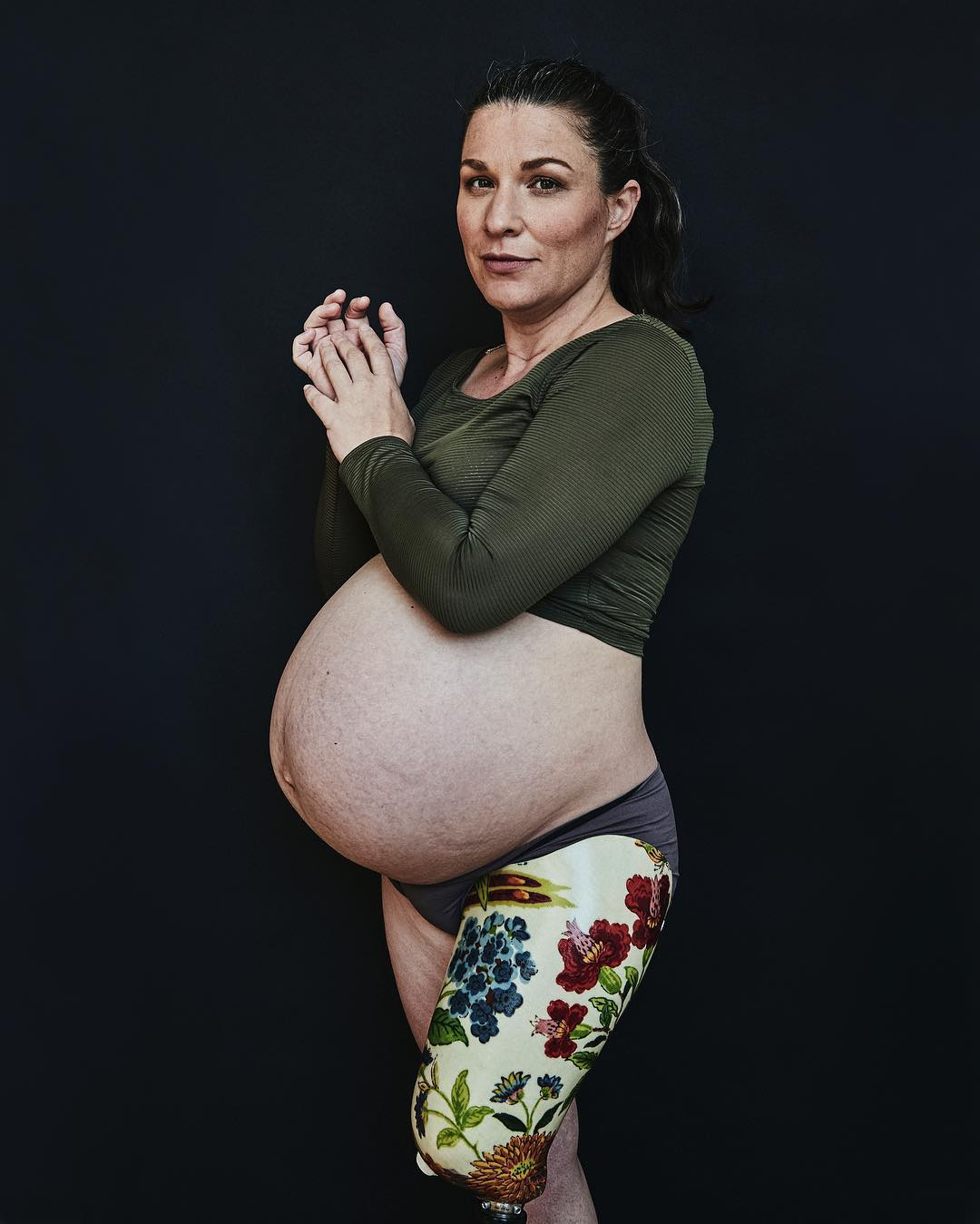 Беременная фотосессия женщины-инвалида покорила соцсети. Смело и красиво!