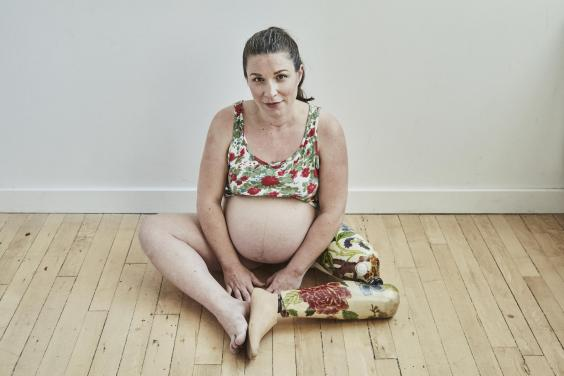 Беременная фотосессия женщины-инвалида покорила соцсети. Смело и красиво!