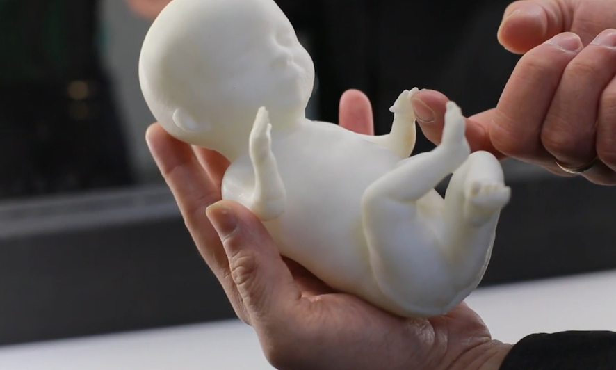 В Уфе начали печатать 3D-модели детей в утробе. Теперь их можно подержать на руках еще до рождения!