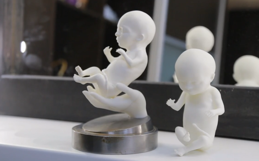 В Уфе начали печатать 3D-модели детей в утробе. Теперь их можно подержать на руках еще до рождения!