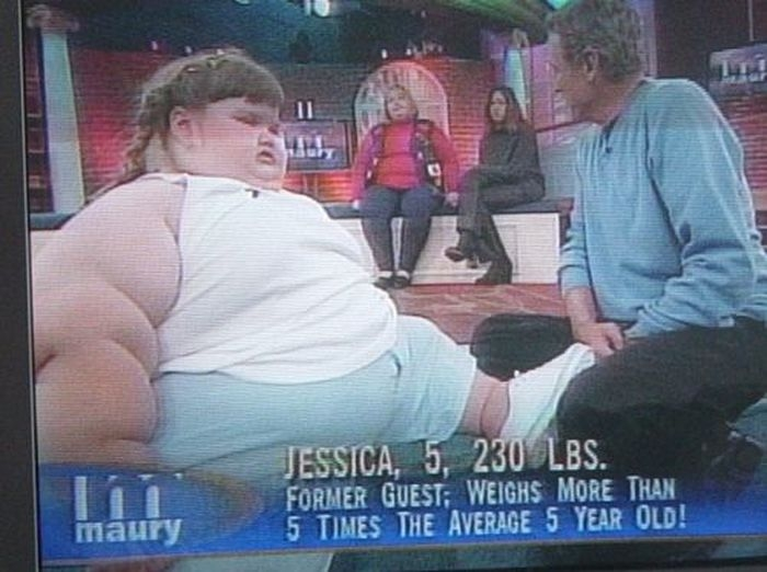 Самой толстой девочке в мире удалось похудеть. Вот как она выглядит сейчас