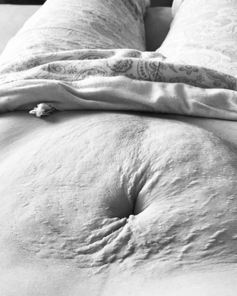 Вот как будет выглядеть живот, если за беременность набрать 25 кг и более