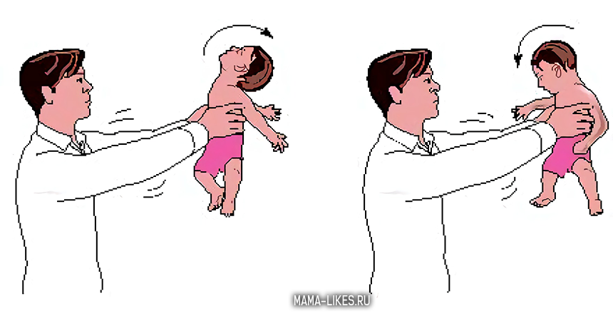 Тряска младенцев. Синдром встряхивания ребенка. Синдром встряхнутого младенца.